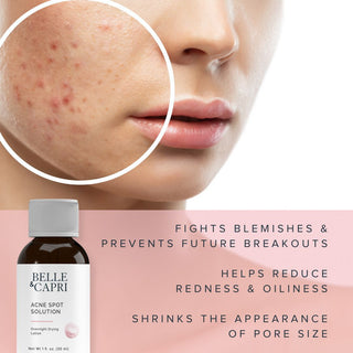 Acne Spot Solution